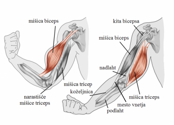 Vnetje mišice bicepc v komolcu (tendinites bicepsa)